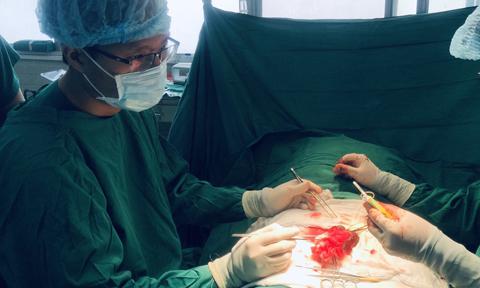 Các bác sĩ đang tiến hành phẫu thuật. Ảnh minh họa