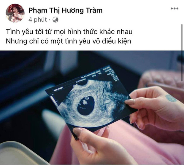 Hương Tràm chia sẻ hình ảnh siêu âm rộ lên nghi vấn mang thai
