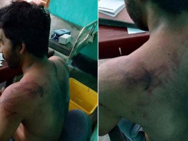 Thế giới - Ấn Độ: Bệnh nhân qua đời vì COVID-19, bác sĩ bị đánh đập dã man