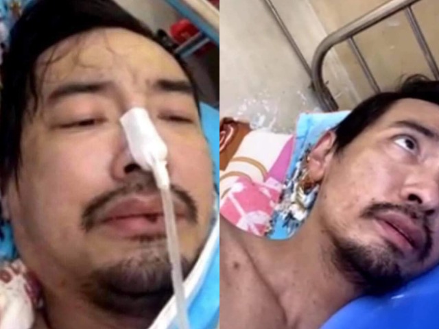 Hình ảnh Việt Quang hốc hác trên giường bệnh "gây sốc" khán giả