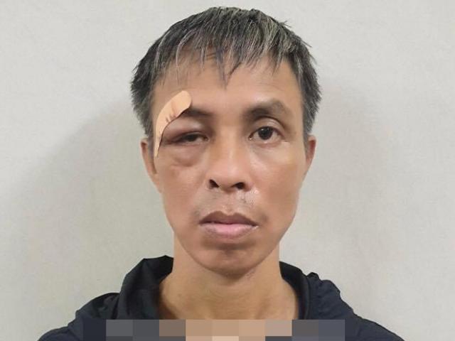 Pháp luật - Buồn chán khi phải chữa bệnh, người đàn ông đâm trọng thương bệnh nhân cùng phòng