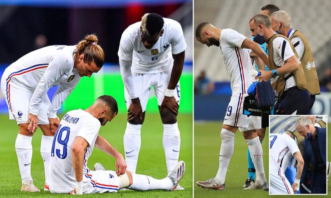 ĐT Pháp lo sốt vó khi Benzema chấn thương trước thềm EURO