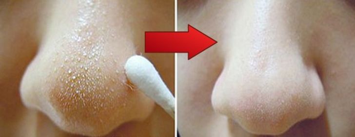 Loạt mẹo làm đẹp nhỏ nhưng có võ giúp bạn có diện mạo tươi tắn như hoa - 2