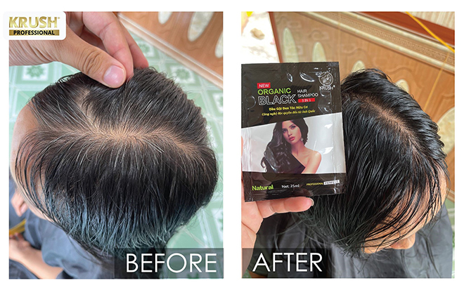 Sự thay đổi của mái tóc trước và sau khi sử dụng dầu gội organic Krush