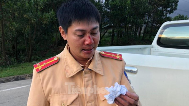 Thượng úy Nghĩa bị đánh chảy máu mũi. Ảnh: Công an cung cấp