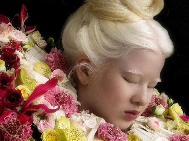 Thời trang - Câu chuyện của cô gái bạch tạng trở thành người mẫu