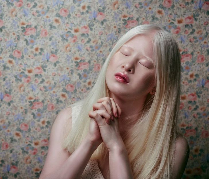 Xueli bắt đầu làm người mẫu từ năm 11 tuổi cho một người bạn của mẹ cô là nhà thiết kế thời trang. Điều này đã khơi mào cho sự khởi đầu sự nghiệp của cô khi cô được các công ty tài năng tiếp cận. Bệnh bạch tạng, là một tình trạng di truyền, liên quan đến các vấn đề về thị lực ở các mức độ khác nhau. Xueli có khoảng 8% đến 10% thị lực. Vì điều này, cô thường nhắm mắt trong các buổi chụp hình. Cô ấy nói trên Instagram của mình rằng đây là “bởi vì ánh sáng hầu như luôn quá sáng. Khi tôi mở mắt ra, tôi hầu như cố đóng chúng ... ”