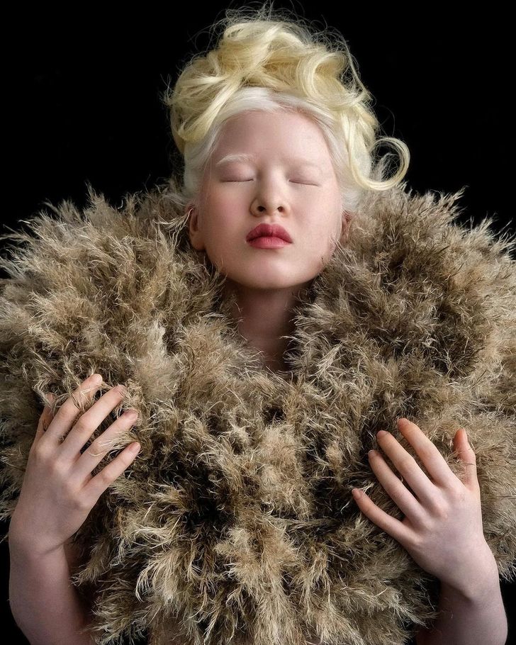 Bất chấp ngành công nghiệp người mẫu quan trọng, Xueli đã trở nên thành công rộng rãi. Mới 16 tuổi, cô đã được xuất hiện trên các ấn phẩm lớn, bao gồm cả Vogue. Hình ảnh của cô ấy cũng đã được trưng bày trong các viện bảo tàng, và cô ấy đã làm người mẫu cho nhiều nhãn hiệu thời trang khác nhau.