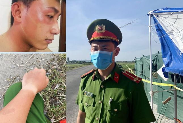 Cuộc chiến chống dịch ở Nghệ An: Rang mình giữa chảo lửa, trắng đêm lấy mẫu xét nghiệm - 4