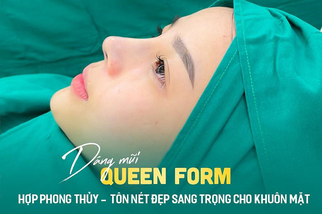 Nghe chuyên gia tư vấn những lưu ý khi nâng mũi Queenform đẹp như mong muốn - 3