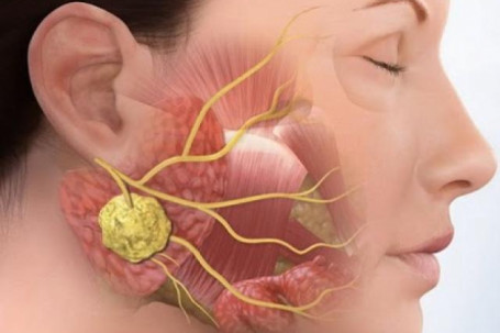 Cô gái trẻ bị suy buồng trứng vì căn bệnh không điều trị kịp thời năm...