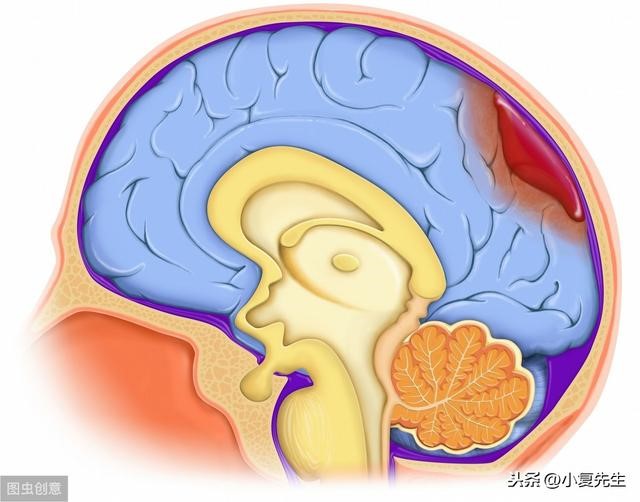 Người đàn ông 41 tuổi nói không với rượu và thuốc lá lại chết vì xuất huyết não do dùng nhiều 4 món này - 3