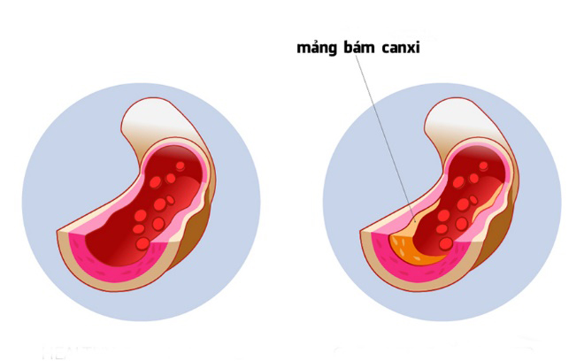 Dân tình “rần rần” bổ sung vitamin K2 hỗ trợ tăng chiều cao cho trẻ hóa ra vì 4 lý do này - 4