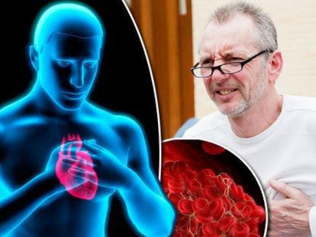 Sức khỏe đời sống - Những thực phẩm "dọn rác" cho mạch máu, ăn thường xuyên có thể ngừa đột quỵ