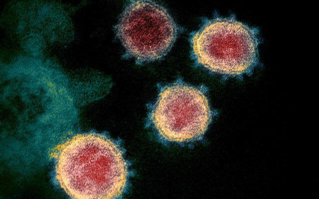 Virus SARS-CoV-2 - Ảnh: NIAID