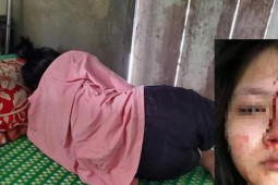 Giáo dục - du học - Nhiều vụ học sinh đánh nhau, ngành giáo dục ‘chẩn bệnh’ bạo lực học đường