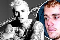 Sức khỏe đời sống - "Hoàng tử nhạc Pop" Justin Bieber mắc căn bệnh lạ, khó chẩn đoán nhưng hậu quả cực nghiêm trọng