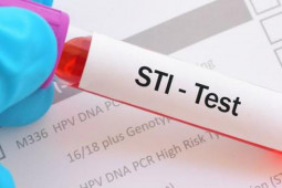 Sức khỏe đời sống - Ngăn ngừa bệnh lây truyền qua đường tình dục có đơn giản như bạn nghĩ?