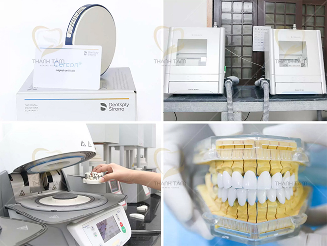 Công nghệ chế tác răng sứ CAD/CAM