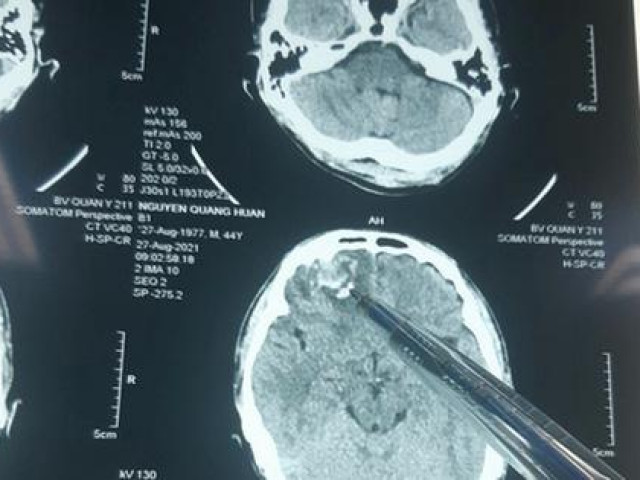 Pháp luật - Công an huyện nói gì vụ dân tố bị đánh, công an nói không có căn cứ xử lý?