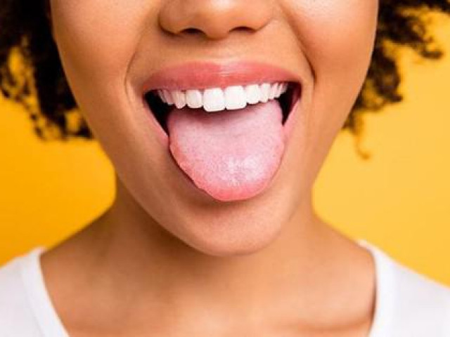 Sức khỏe đời sống - Những dấu hiệu ở lưỡi cảnh báo bệnh nguy hiểm, đi khám ngay kẻo "ân hận mấy cũng muộn"