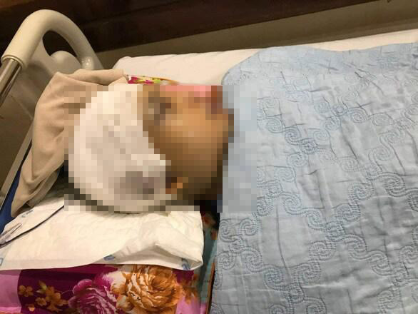 Ông Nguyễn Văn Hành điều trị tại bệnh viện.