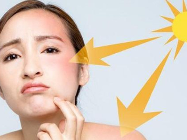 Sức khỏe đời sống - Dùng kem chống nắng kiểu này biến "cứu tinh" thành "tội đồ" của da