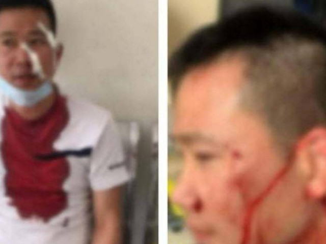 Pháp luật - Tài xế tố bị nhóm "cò" đánh trong Bến xe Mỹ Đình vì tự ý bắt khách