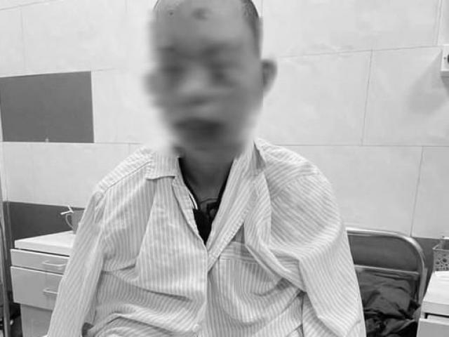 Tin tức trong ngày - Tin tức 24h qua: Thanh niên cháy sém toàn thân, nguy cơ mù vì vừa dùng điện thoại vừa sạc