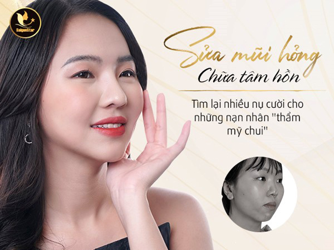 "Sửa mũi hỏng – chữa tâm hồn" mùa 3: Tìm lại nụ cười cho nạn nhân của thẩm mỹ chui - 1