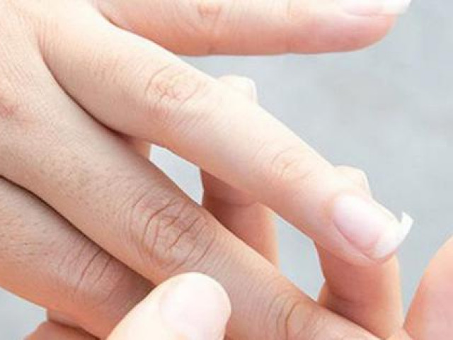 Sức khỏe đời sống - Xuất hiện 8 dấu hiệu này cảnh báo cơ thể bạn đang thiếu canxi trầm trọng, nên kiểm tra ngay để phòng hậu hoạ