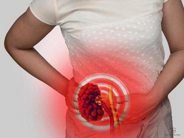 Sức khỏe đời sống - Những dấu hiệu cho thấy thận của bạn đang "kêu cứu", đi khám ngay kẻo muộn