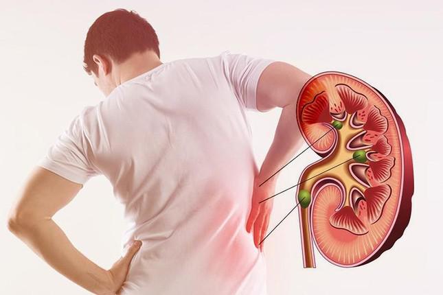 Signs that your kidneys are "calling for help", go to the doctor right away before it's too late - 1