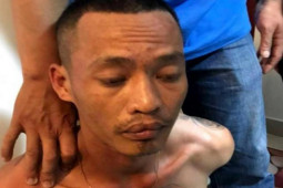 Pháp luật - Cặp giang hồ Hùng "sứt", Hùng "mùi" nổ súng truy sát làm 4 người bị thương