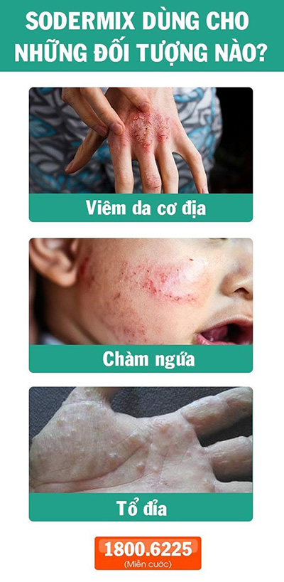 Viêm da chữa mãi không khỏi, Phó Giáo sư mách mẹo này "mừng như bắt được vàng" - 6