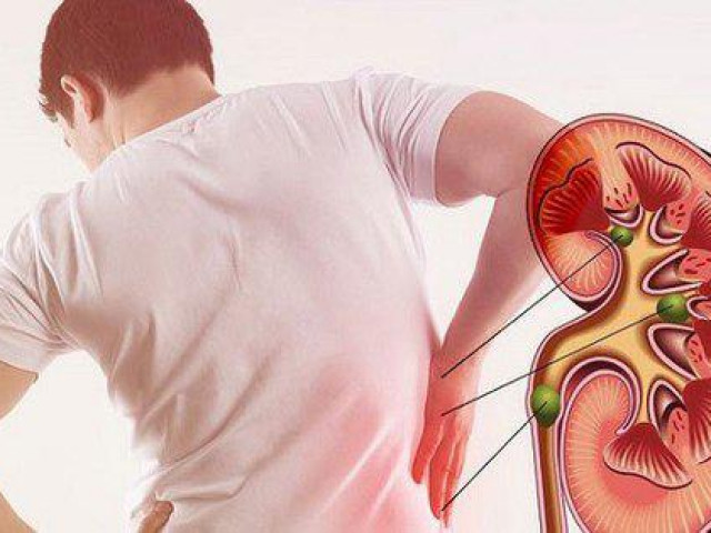 Sức khỏe đời sống - 10 dấu hiệu chứng tỏ thận của bạn đang có vấn đề