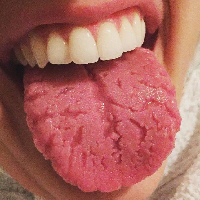 Abnormal signs on the tongue warn of dangerous diseases - 1