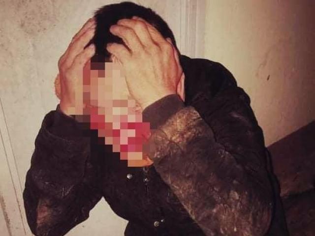 Pháp luật - Làm rõ vụ việc một người nghi trộm chó bị bắt giữ, hành hung