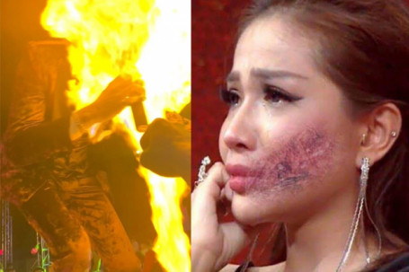 Nữ DJ Đà thành hốt hoảng khi bị lửa táp thẳng mặt, CEO Hậu Giang bỏng nặng cấp 2