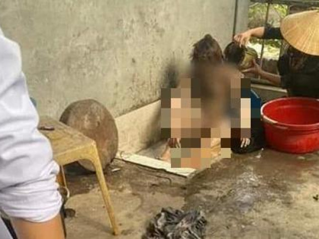 Pháp luật - Nghi vấn mâu thuẫn gia đình, chồng đổ xăng đốt phòng ngủ khiến 3 người bị thương