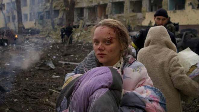 Người đứng đầu phái bộ giám sát nhân quyền của LHQ tại Ukraine cho biết số người Ukraine thiệt mạng trong chiến dịch quân sự của Nga thực chất cao hơn vài nghìn so với con số được công bố. Ảnh: AP
