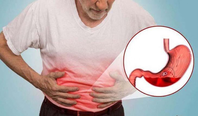 Stomach pain due to stress, staying up late: What to do to improve the condition?  - first