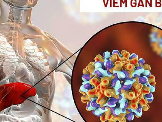 Nhiễm virus viêm gan B sau bao lâu thì xuất hiện triệu chứng và tiến triển thành ung thư gan?