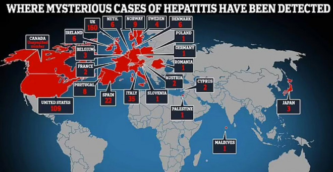 Bệnh viêm gan bí ẩn tiếp tục diễn biến phức tạp trên toàn thế giới - 1