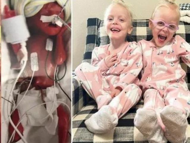 Bạn trẻ - Cuộc sống - Cặp song sinh chào đời khi mới được 22 tuần 1 ngày và hành trình sống mãnh liệt