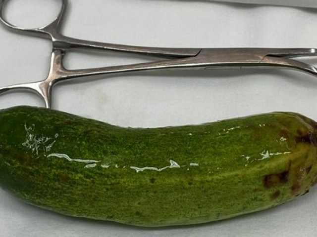 Sức khỏe đời sống - Thử "cảm giác lạ", thanh niên nhét quả dưa leo dài hơn 10cm vào hậu môn