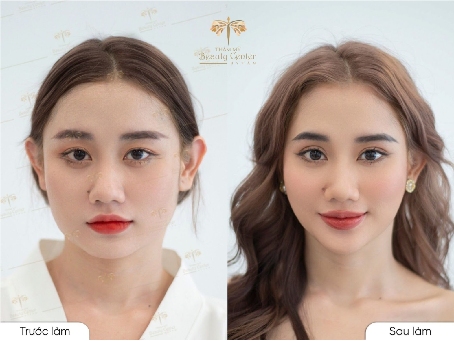 Bạn khách chia sẻ: “Hồi trước đi học, bị mấy bạn nam trêu là mặt to như bánh bao, lúc đấy tự ti xong đôi lúc còn hơi tủi thân. Nhưng vì học sinh nên cũng chưa có đủ kinh phí đi làm đẹp. Hiện tại thì công việc mình làm thường xuyên giao tiếp với khách hàng nên ngoại hình là một phần rất quan trọng. Phương pháp này đã giúp mình tự tin hơn rất nhiều, mình rất vui và muốn gửi cảm ơn đến Tấm”.