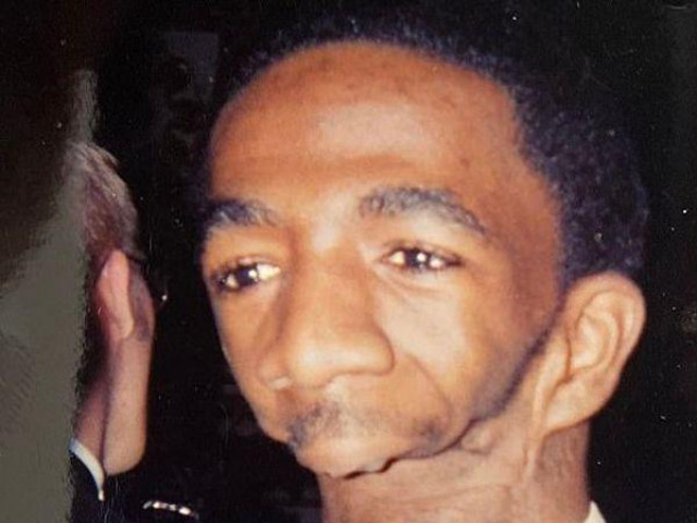 Phi thường - kỳ quặc - Người đàn ông bẩm sinh không có hàm: Bị cha mẹ ruồng bỏ, hạnh phúc bên người vợ xinh đẹp