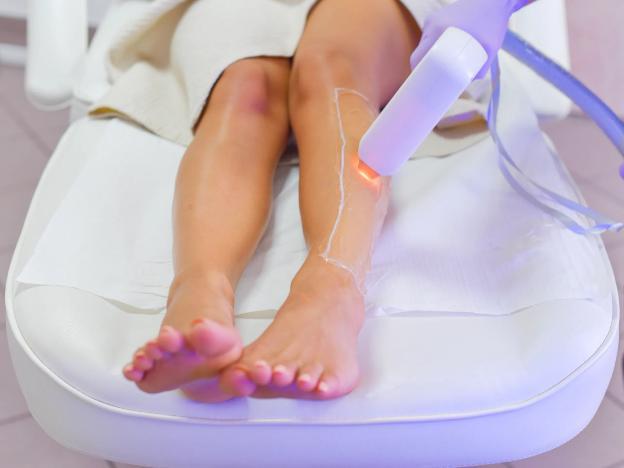 Laser hair removal, everything you need to know - 4