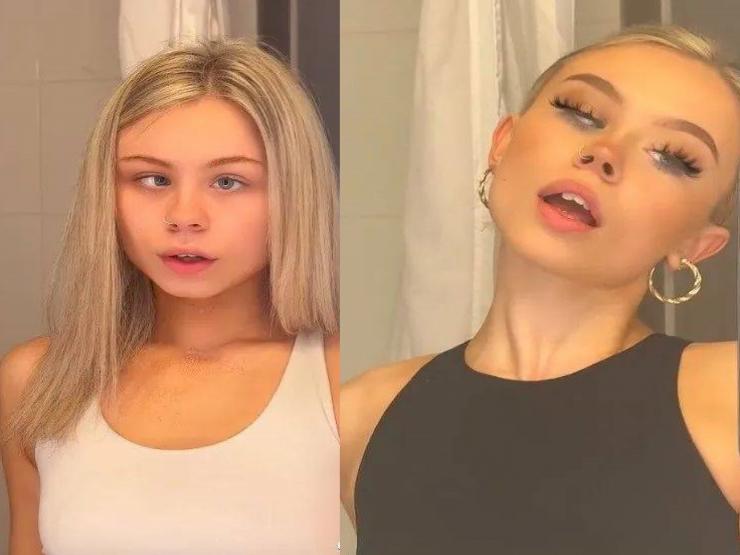 Bạn trẻ - Cuộc sống - Cô gái luôn bị chế giễu vì đôi mắt lác nay trở thành hot TikToker